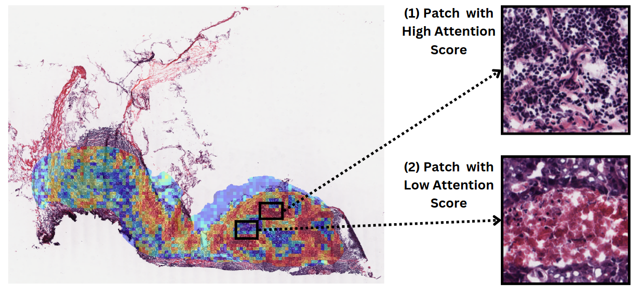 Heatmap of model prediction for T-cell mediated cytotoxicity
